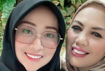 Potret Terbaru Elly Sugigi Usai Potong Gigi, Terlihat Beda Banget