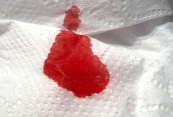 Ini 7 Kondisi Darah Menstruasi yang Penting untuk Kamu Ketahui