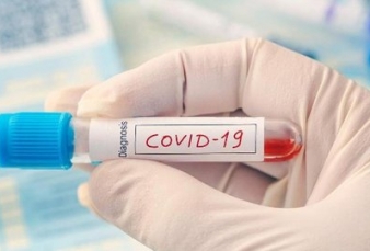 Pasien Covid-19 Isolasi Mandiri Ditemukan Meninggal Dunia