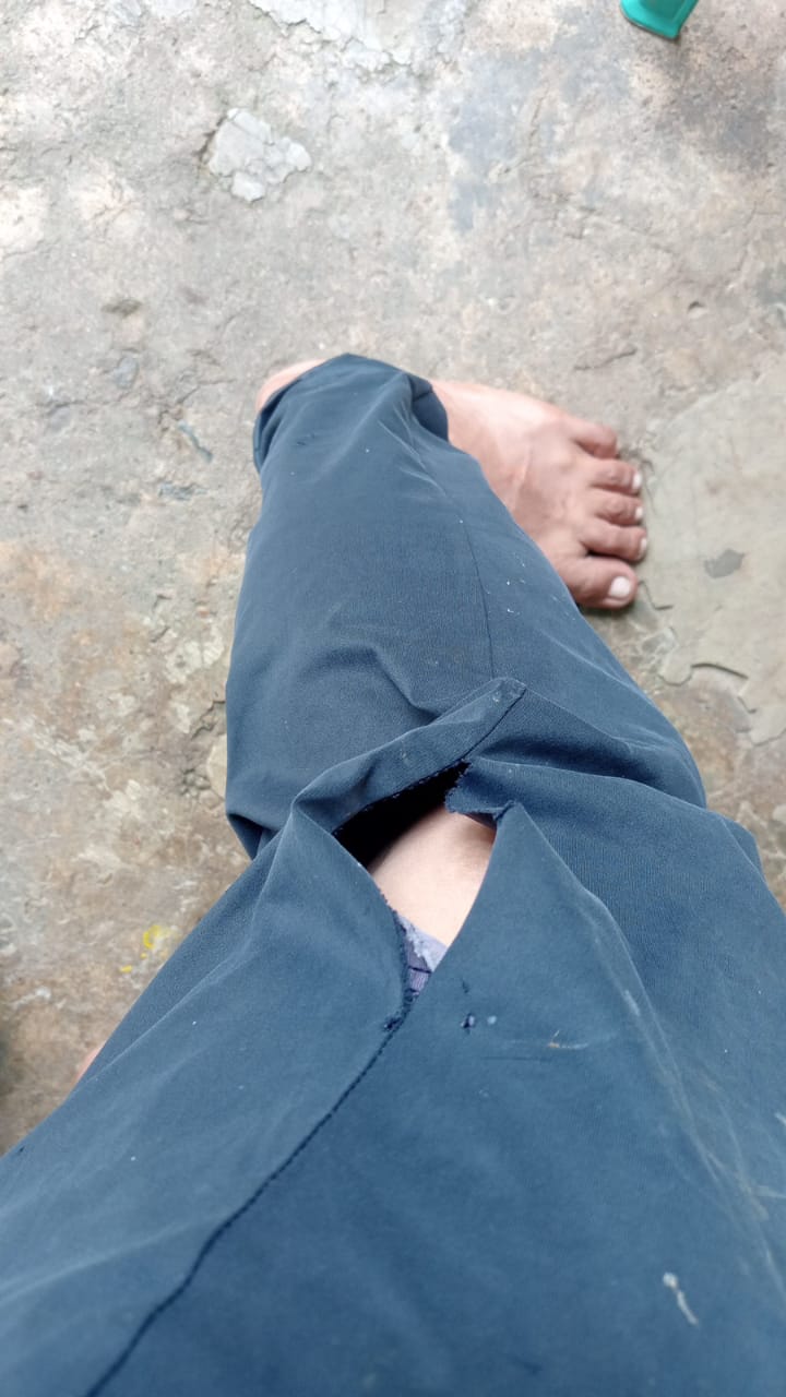 Warga Jadi Korban Gigitan Anjing, Pemkab Kuansing Diminta Turun Tangan