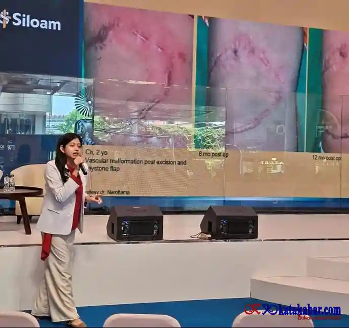 Perdana Bedah Plastik, Rekonstruksi dan Estetik Standar Korsel di Siloam Hospital TB Simatupang