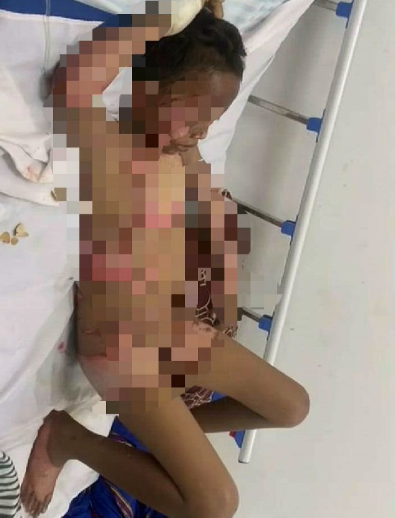 Kasat Reskrim : Bukan Dibakar,  Disiram Bensin Lalu Terbakar