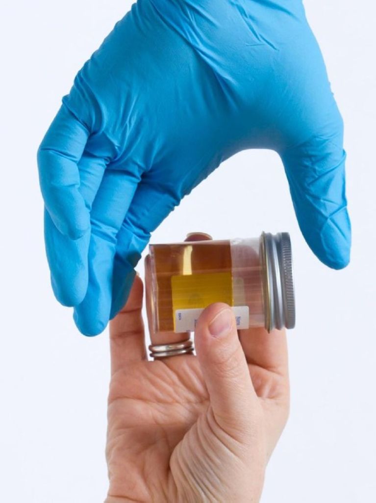 Dua Pejabat Labuhanbatu  Diminta Tes Urine Jajaran